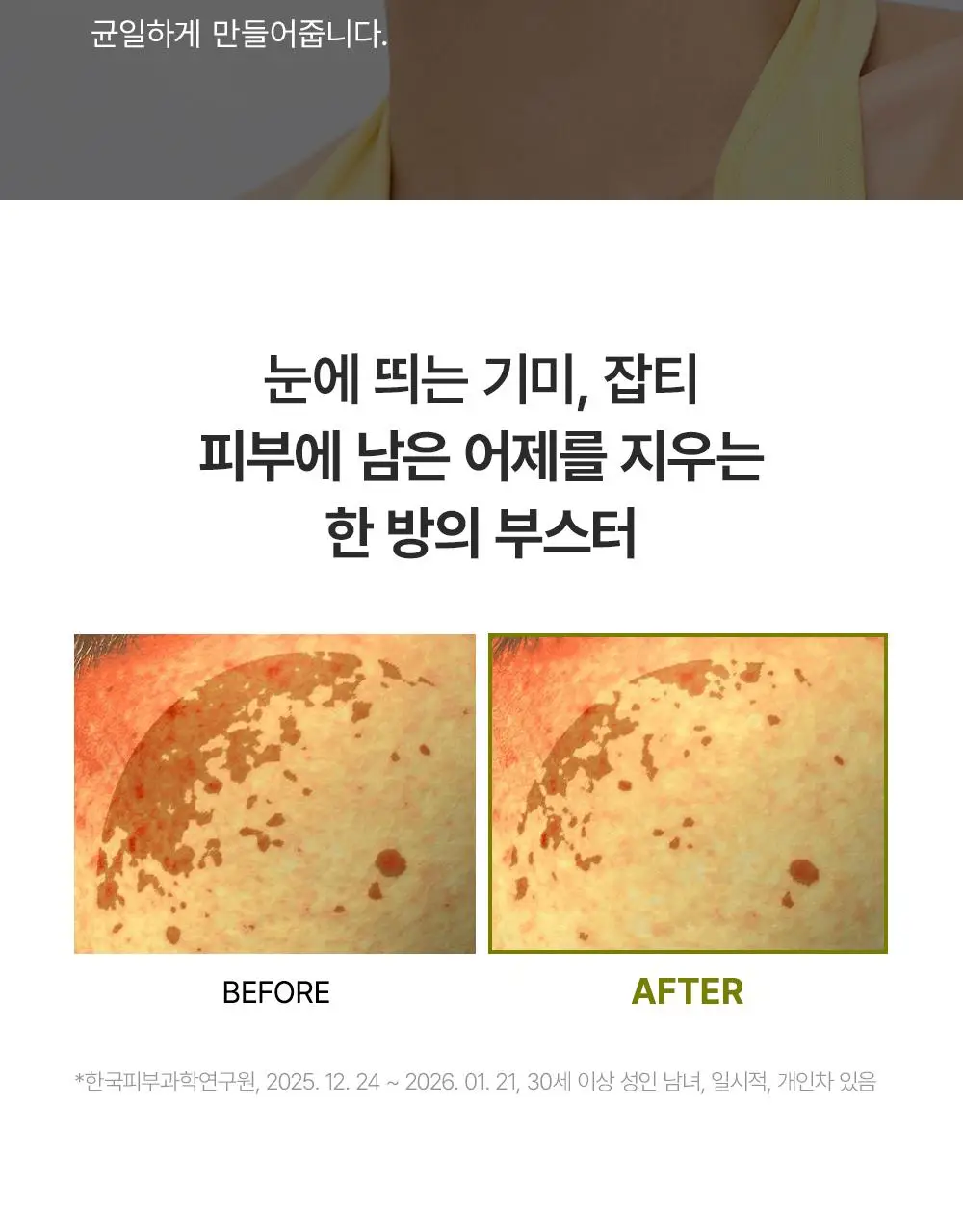 [30ml+30ml / 강력토닝케어] 아렌시아 비타민 C 부스터 샷 30ml 더블기획 상세페이지 8